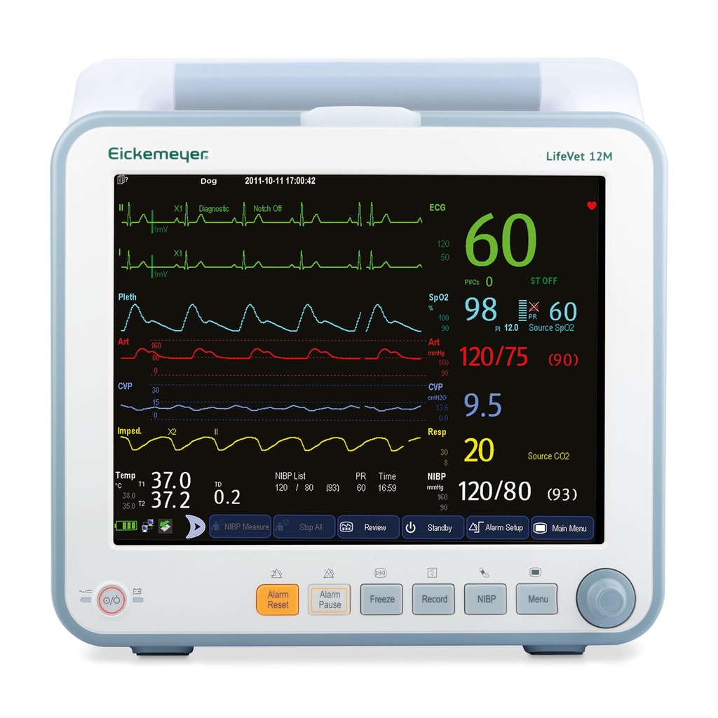 Mindray Magic 6000+ met kleuren doppler