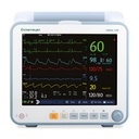 Mindray Magic 6000+ met kleuren doppler