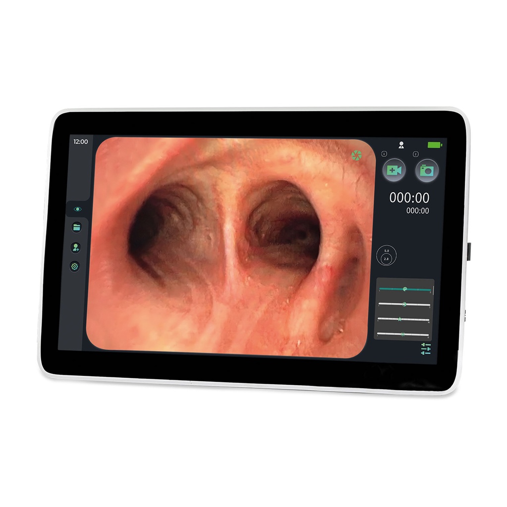 EickView SD endoscopie monitor, 15.6" touchscreen