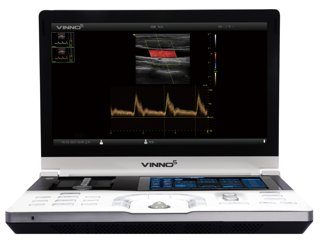 VINNO 5 VET draagbaar echografieapparaat