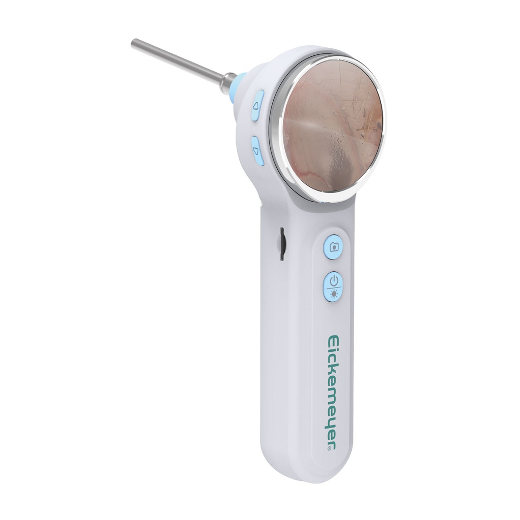 [300130] EickView OTO - Digitale video-otoscoop