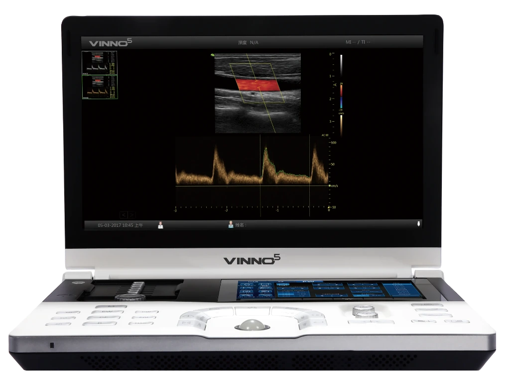 Vinno 5 Vet met micro-convex transducer