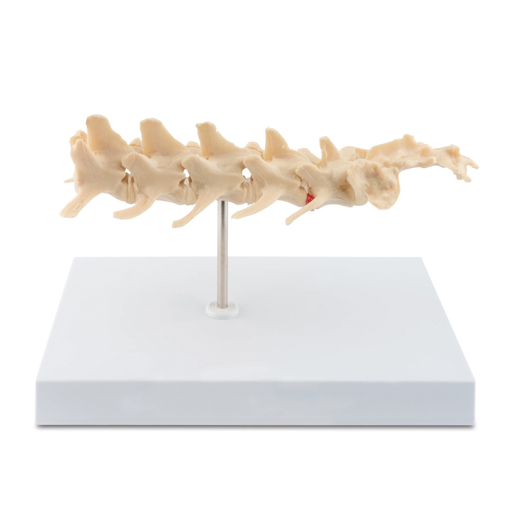 osteo-model type: wervelkolom  