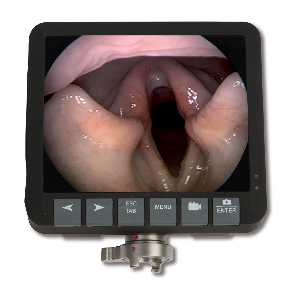 3,5" opzetmonitor voor Eickview 60, 70, 100E, 150E